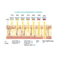 五大光子嫩膚技術（IPL、DPL、OPT、APT、BBL）及濾光片區(qū)別